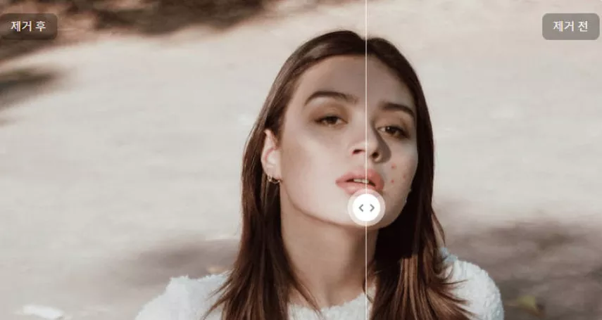 여드름 흉터 없애는 법