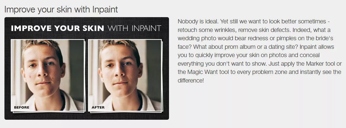 여드름 흉터 없애는 법 